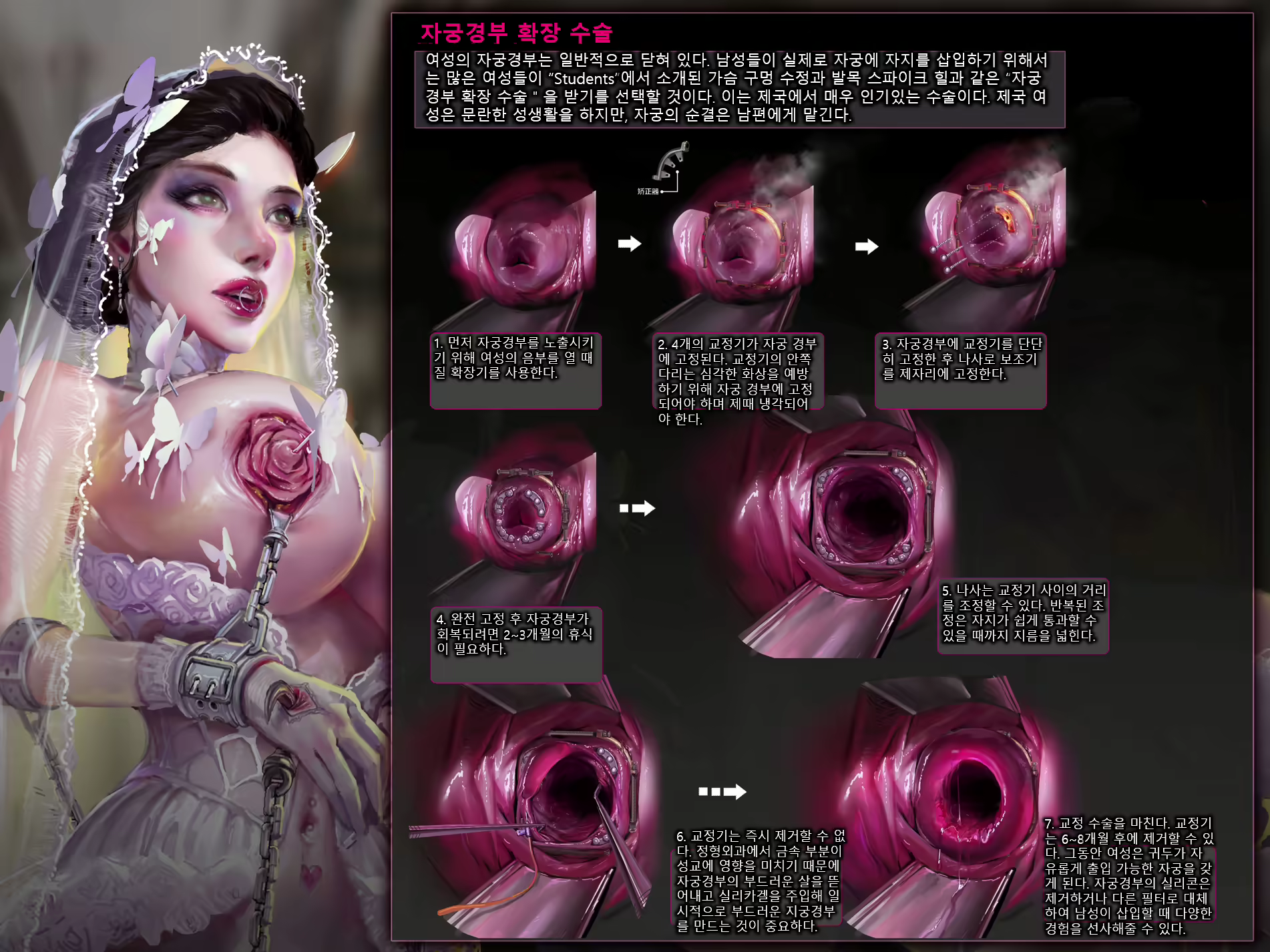 Content 1936476 - 8 페이지